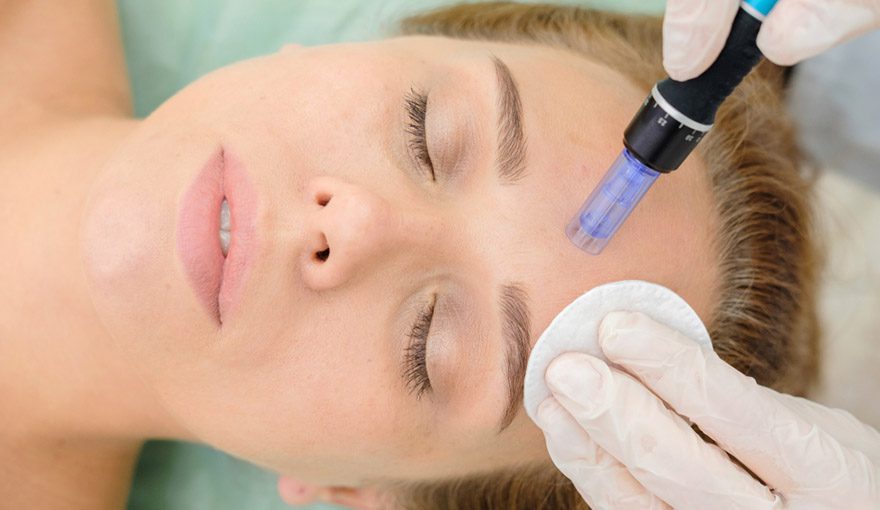 Microneedling treatment at Medipro Clinics