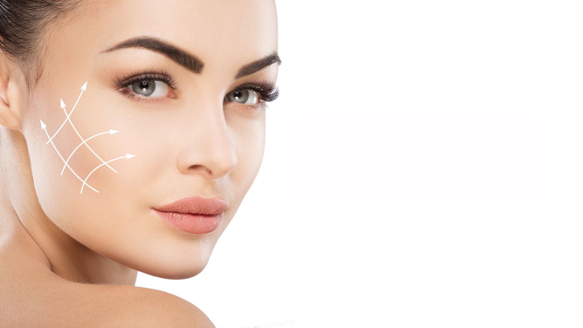 PDO thread lift treatment at Medipro Clinics